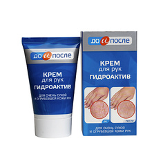 Крем для рук ДО И ПОСЛЕ Крем для сухой кожи рук Гидроактив 100